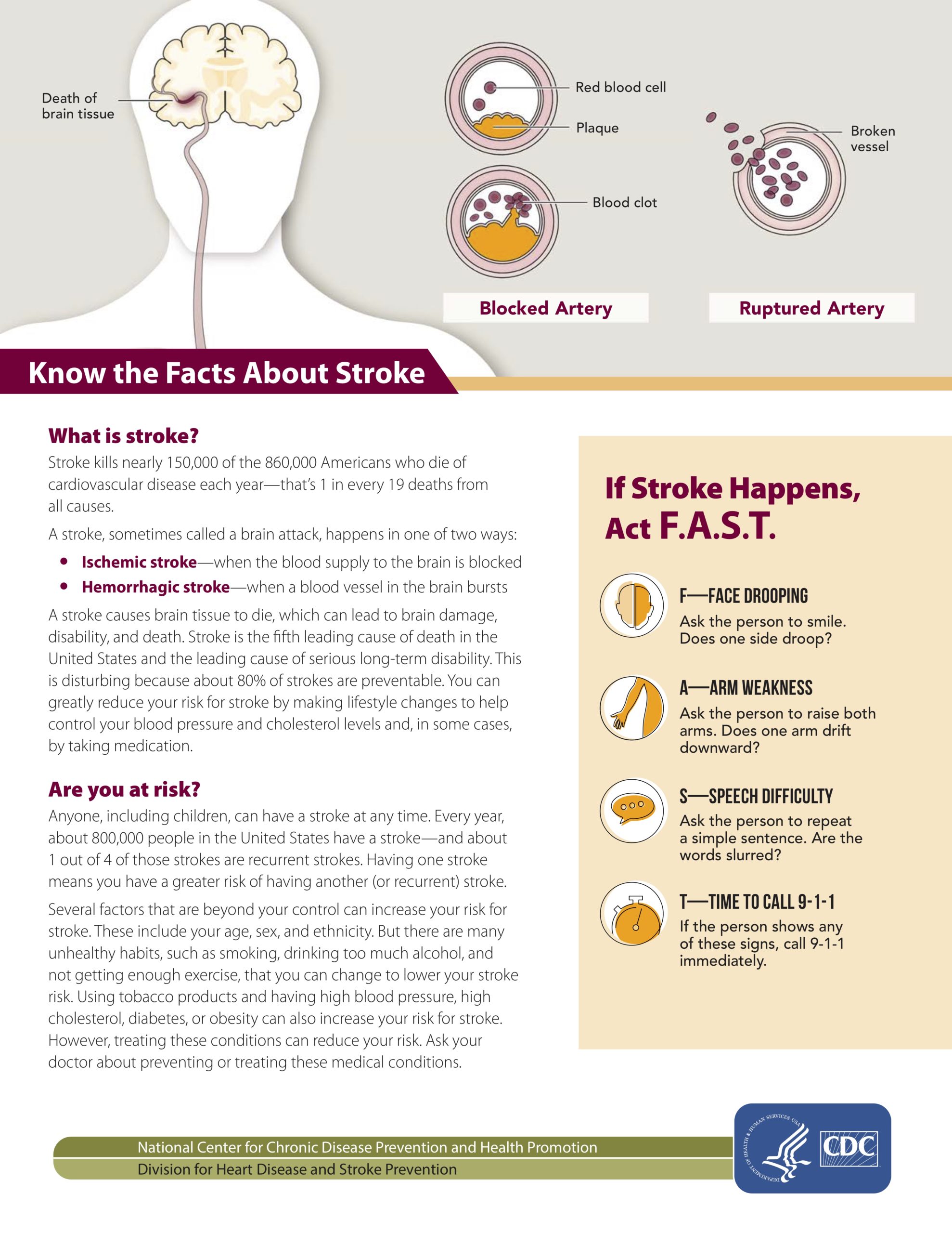 National Stroke Organizations and Resources – Greater Cincinnati Stroke ...